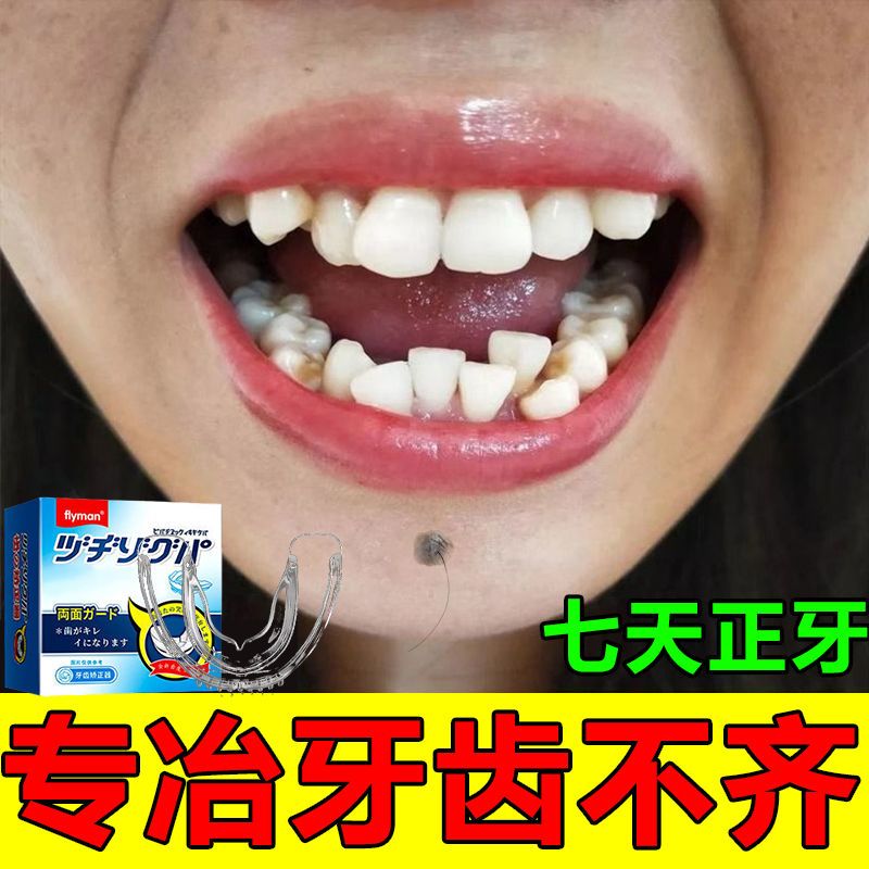 【龅牙有救了】牙套牙齿矫正器龅牙凸嘴成人儿童学生正畸隐形牙套