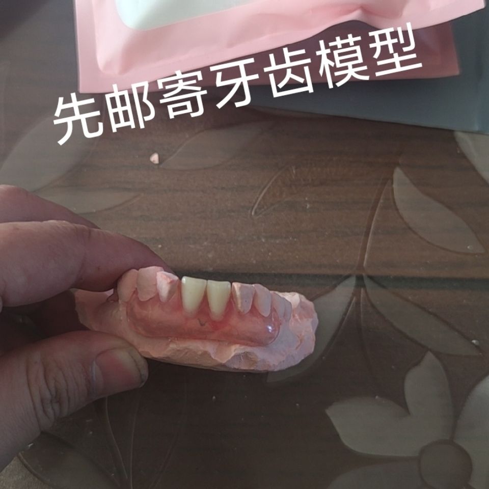 私人订制:国产隐形义齿 树脂活动假牙可摘戴【3月14日发完】