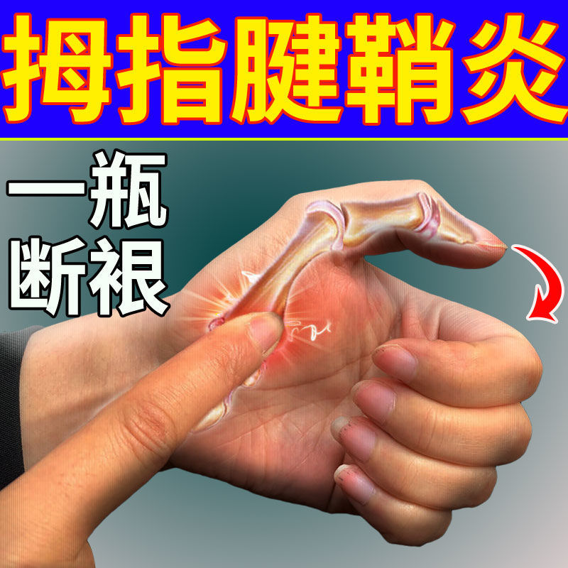 大拇指腱鞘炎【不用开刀】手指手腕疼痛腱鞘囊肿鼓包弹响屈伸困难