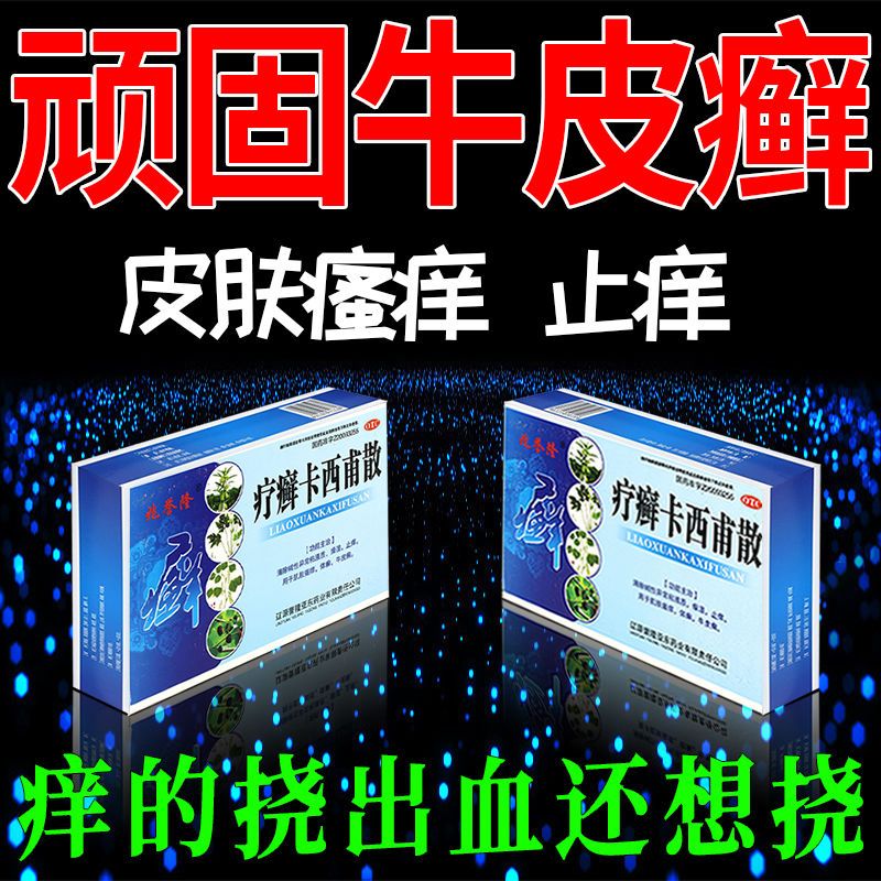 顽固牛皮癣口服药止痒银屑病皮肤瘙痒红肿起皮干裂疗癣卡西甫散