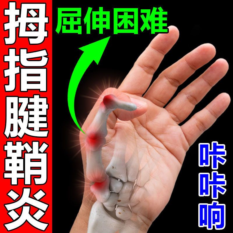 大拇指腱鞘炎凝露手指腕腱鞘囊肿关节肿胀疼痛变形鼓包活动受限