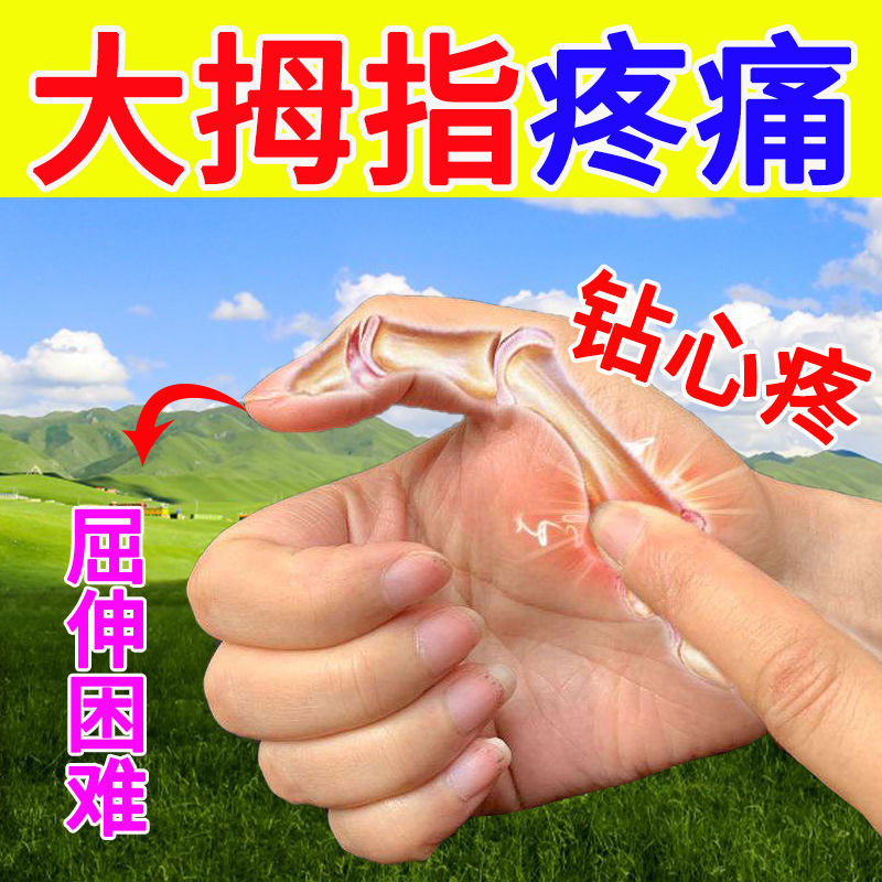 大拇指腱鞘炎【不用开刀】手指手腕疼痛腱鞘囊肿鼓包弹响屈伸困难