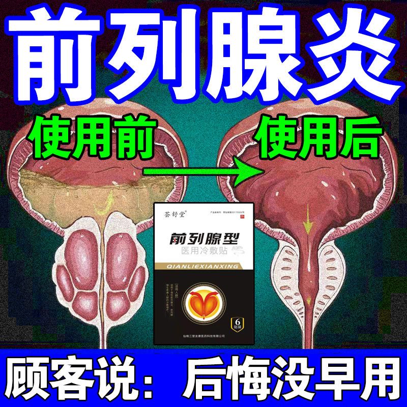 前列腺炎贴尿频尿急增生肥大阴囊潮湿中药遗尿尿不尽尿分叉尿等待