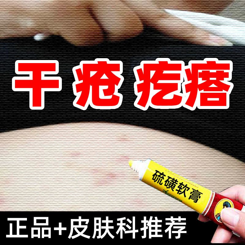 医用硫磺软膏干疮除螨虫疥疮虫结节疙瘩阴虱全身皮肤干痒抑菌乳膏