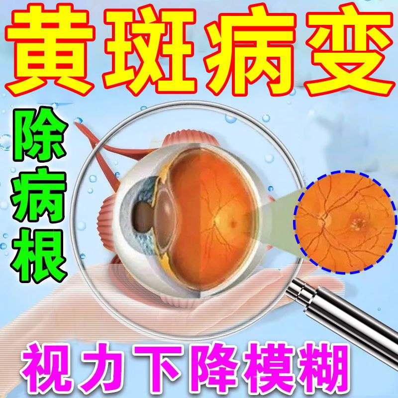 【好用】黄斑病变眼药水眼底黄斑视力下降视物变形有黑影黄斑变形