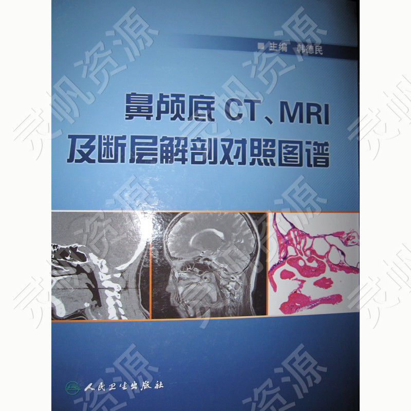 鼻咽部断层解剖图谱pdf电子版.