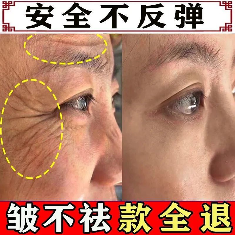 【拍1发2】六胜肽抗皱水光面霜去皱纹抬头纹美白补水去细纹抗衰老