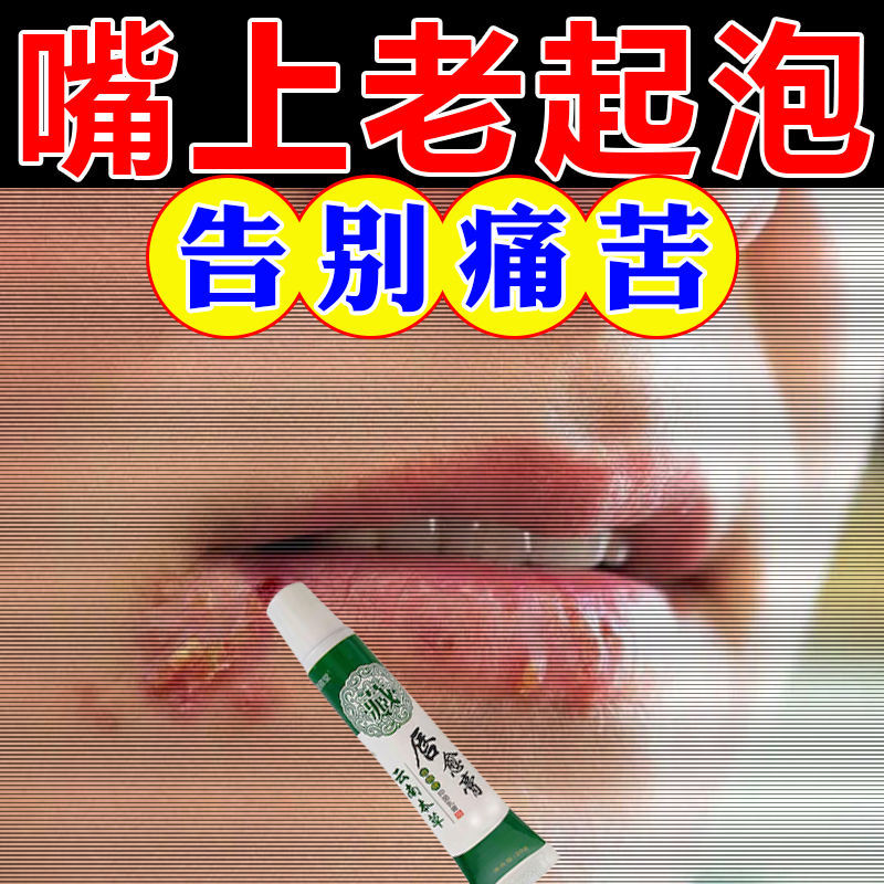 嘴唇起泡烂嘴角起水泡嘴巴上火嘴巴脓疮口角红肿发痒溃烂上火起泡