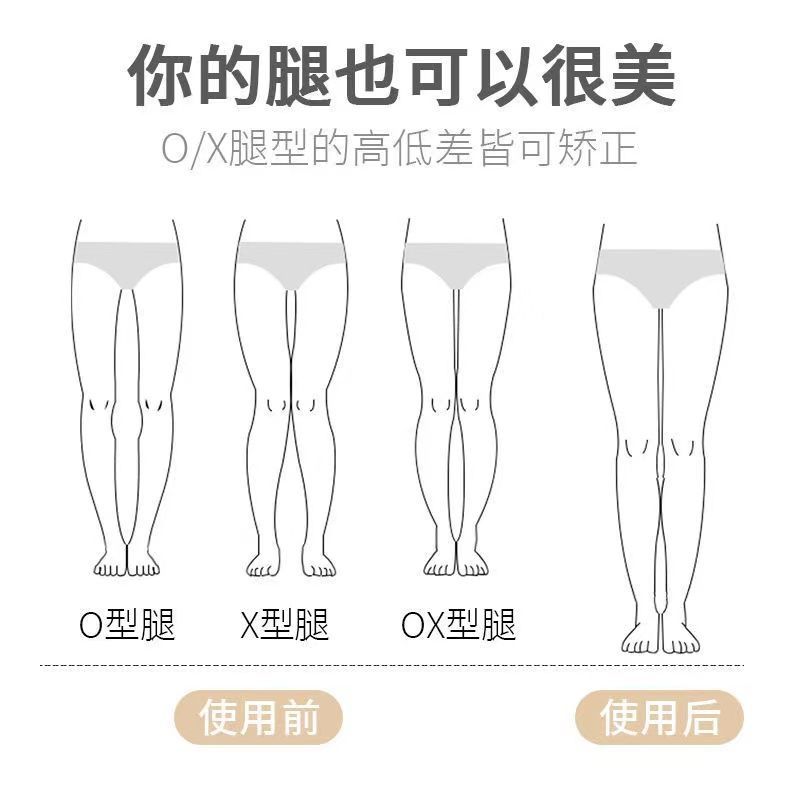 o型腿矫正神器直腿鞋垫 o形腿xo型x型腿矫正器小腿外翻脚纠正腿型