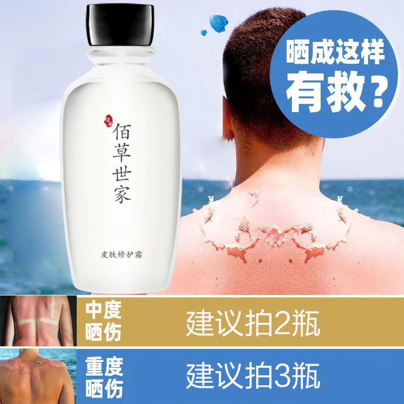 曬後修復霜曬傷曬黑脫皮曬紅腫補水保濕變白男女夏天