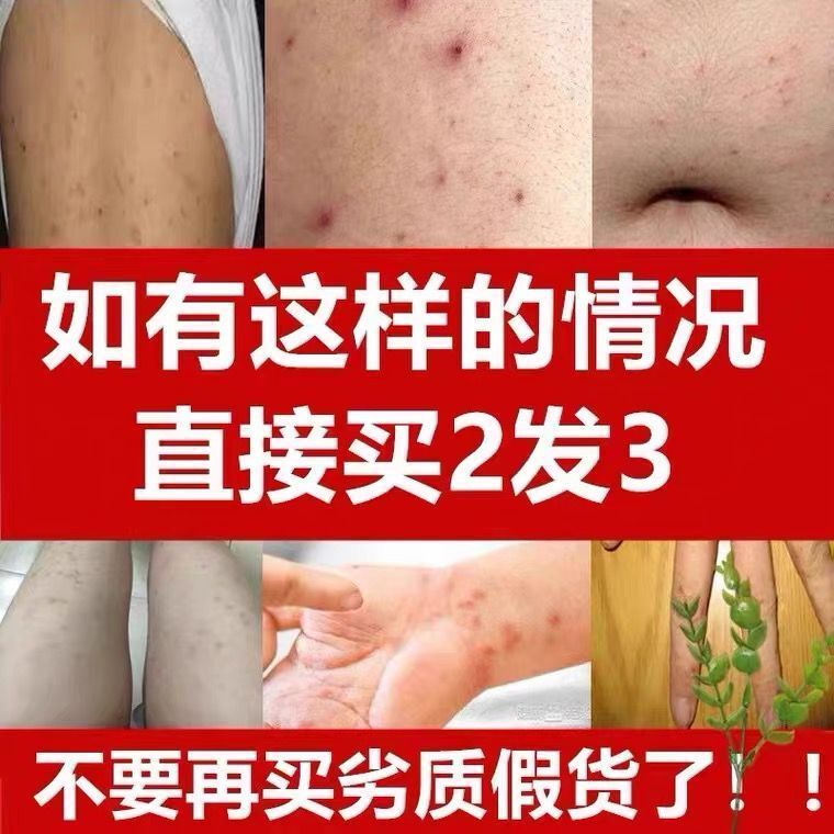 疥疮膏特效疥苍结节疥虫阴虱去螨虫大腿内侧皮肤瘙痒止痒硫磺软膏