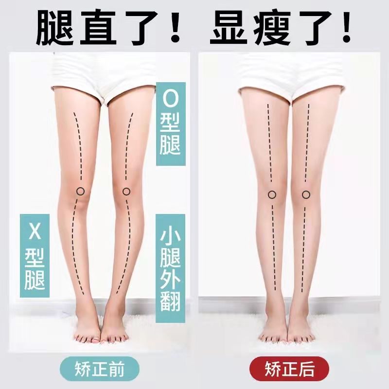 o型腿矫正鞋垫直腿神器矫正腿型o形腿纠正器xo型腿内外八小腿外翻