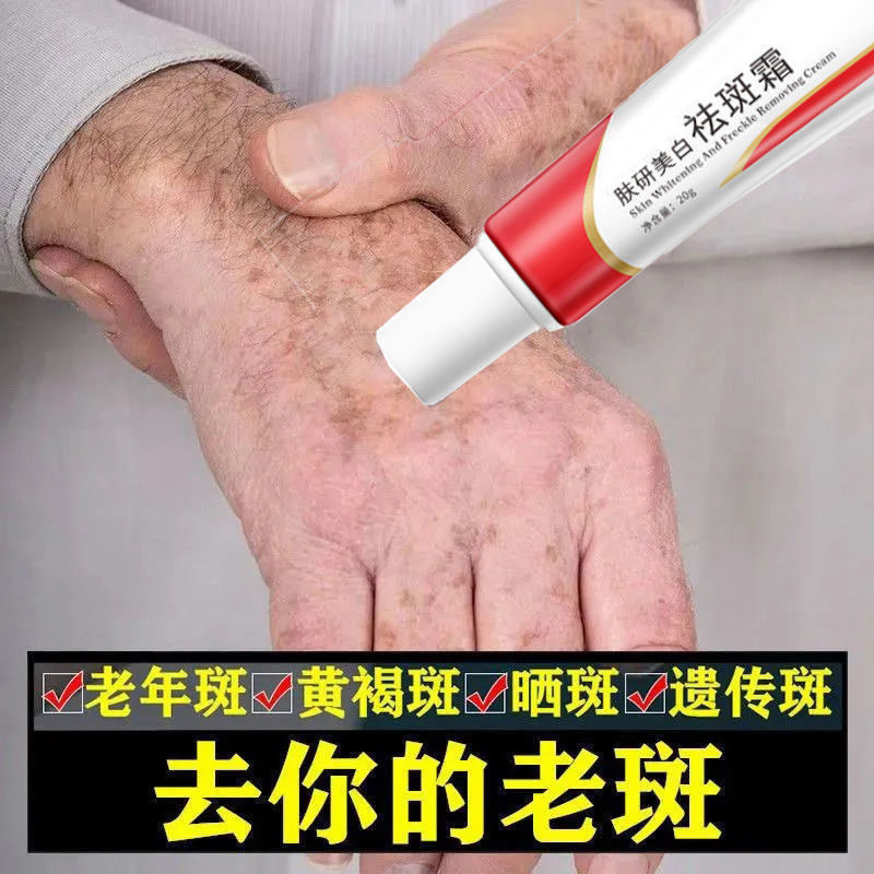 【专祛老年斑】祛斑霜快速无痕除斑点黑色素淡斑产品防晒美白神器