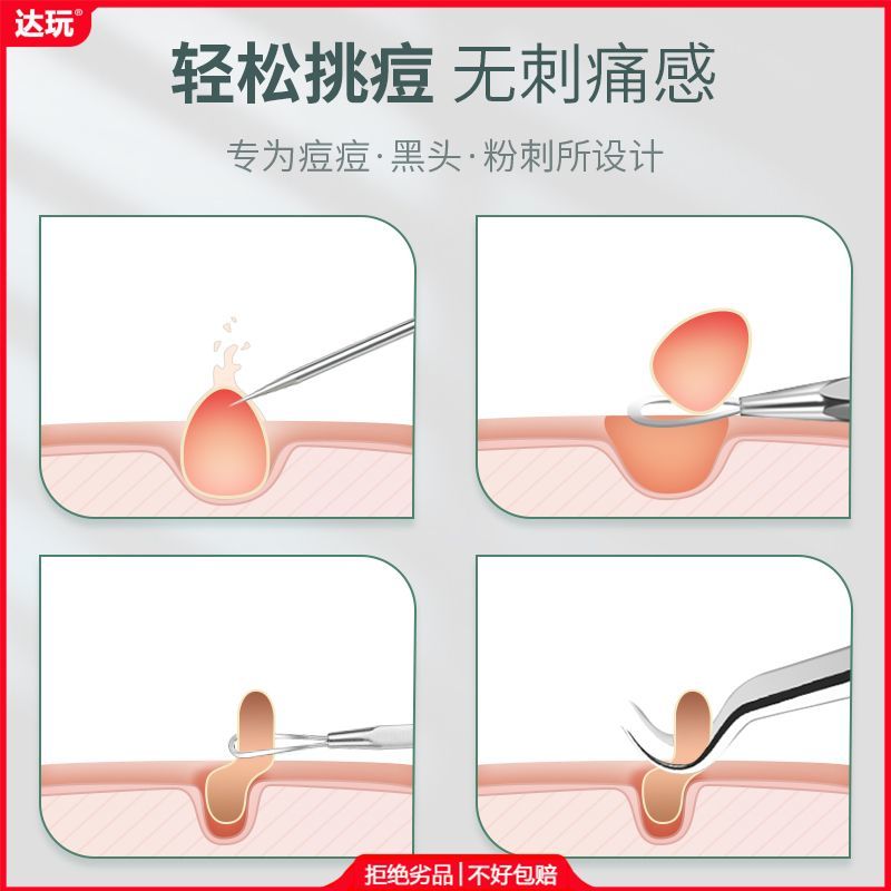 新款】粉刺针去黑头祛痘镊子细胞夹挤痘痘工具美容院专用神器套装