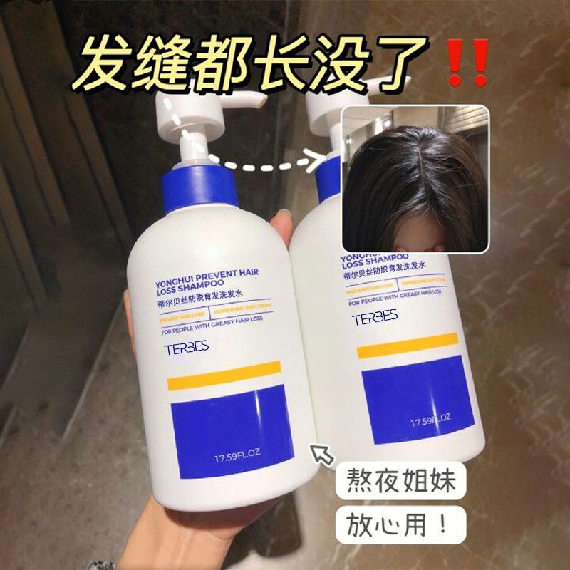 【頭皮護理推薦】洗髮水防脫育發防掉發男士女士洗頭水柔順洗髮露