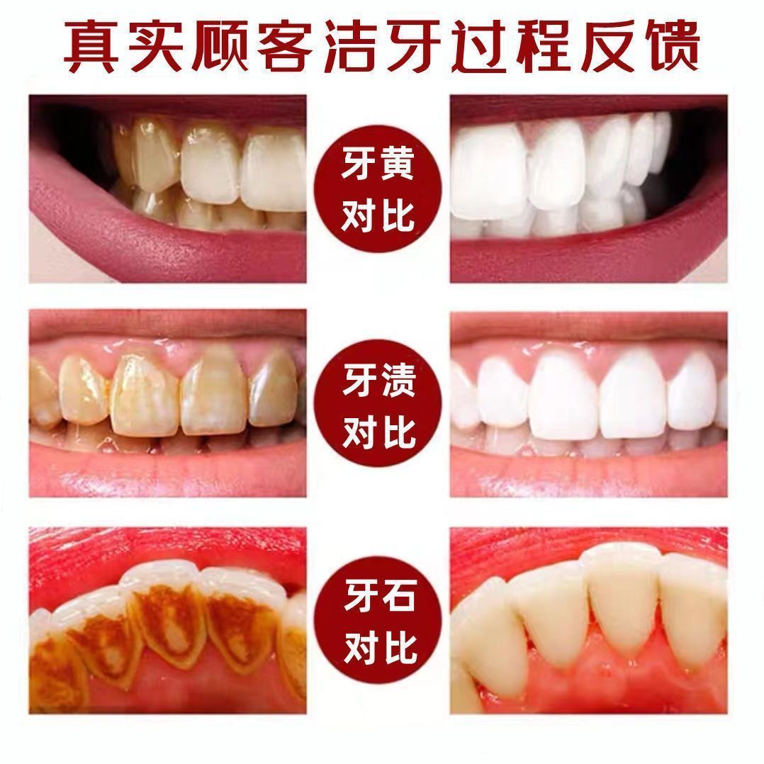 去牙结石牙齿美白去牙渍去黄牙烟渍牙膏脱色去除剂免洗牙口气清新