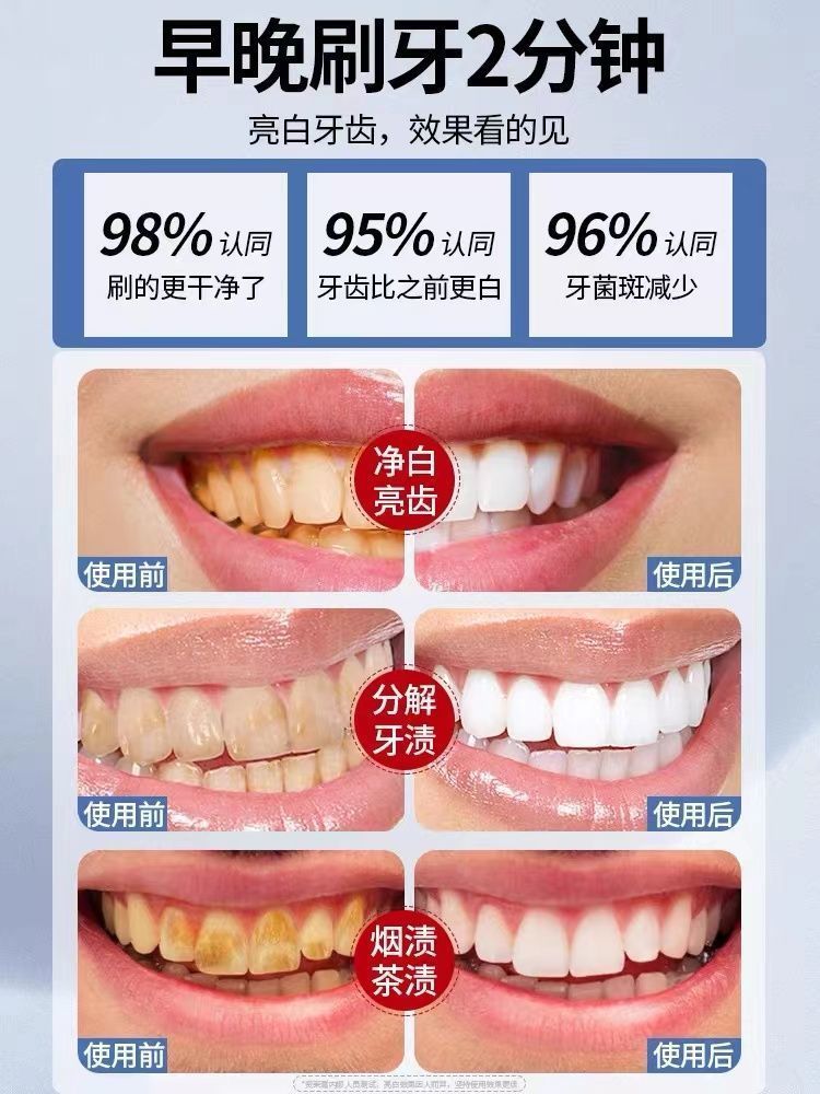去牙结石牙齿美白去牙渍去黄牙烟渍牙膏脱色去除剂免洗牙口气清新