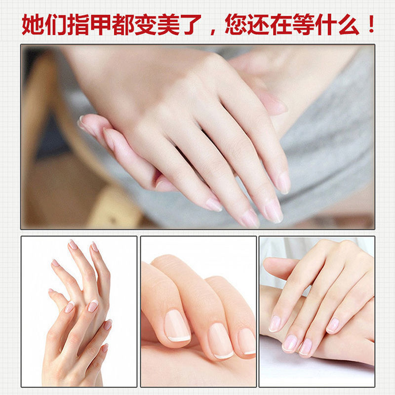 Herborist nail growth water, nail biting, rapid growth, nutritional thickening, nail polish, gray finger repair essential oil