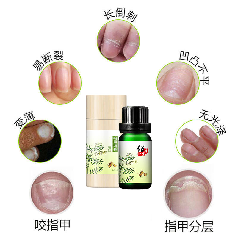 Herborist nail growth water, nail biting, rapid growth, nutritional thickening, nail polish, gray finger repair essential oil