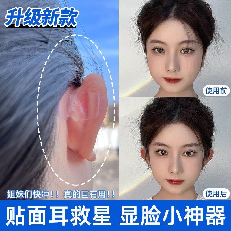 升級款精靈耳貼立耳貼隱形防水定型耳朵支撐器變招風耳大臉顯小