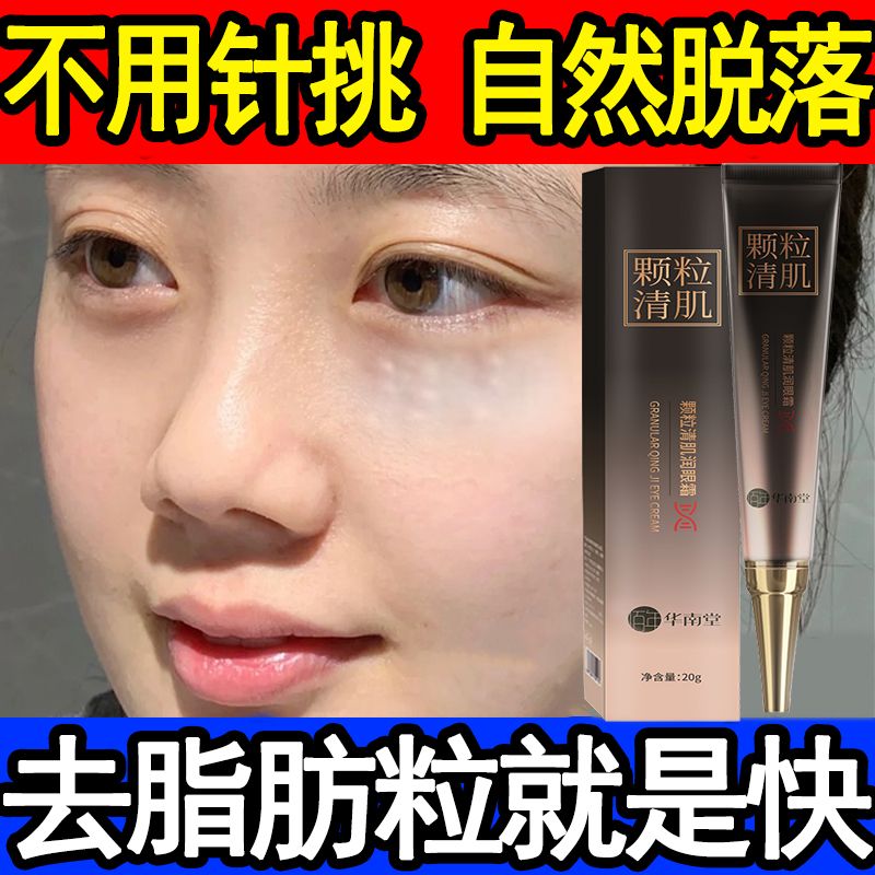 【脂肪粒去除神器】華南堂眼霜去脂肪粒汗管粒油脂粒去黑眼圈眼袋