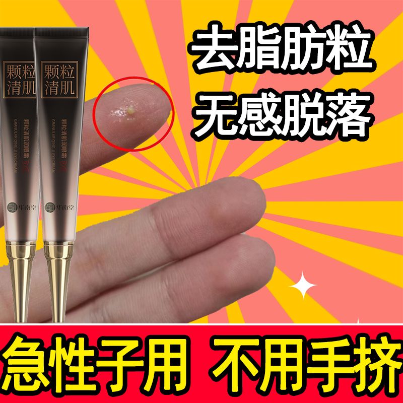【脂肪粒去除神器】顆粒清肌眼霜去油脂粒去眼袋皺紋精華素液精油