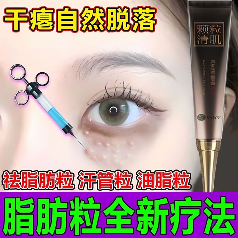 【脂肪粒去除神器】華南堂眼霜去脂肪粒汗管粒油脂粒去黑眼圈眼袋