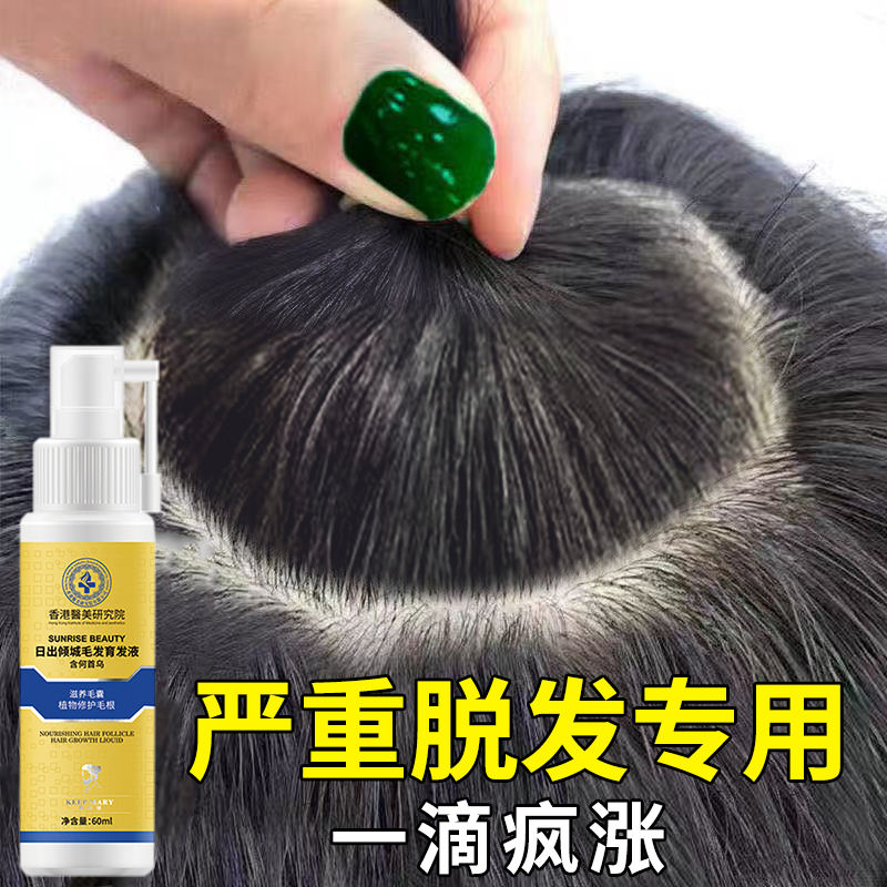 【官方正品】防脫育發液快速生髮液密發產後掉頭髮增洗髮水