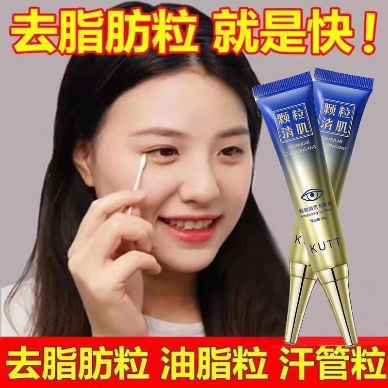 【國貨推薦】去脂肪粒眼霜汗管粒去除神器重度去油脂粒眼周顆粒
