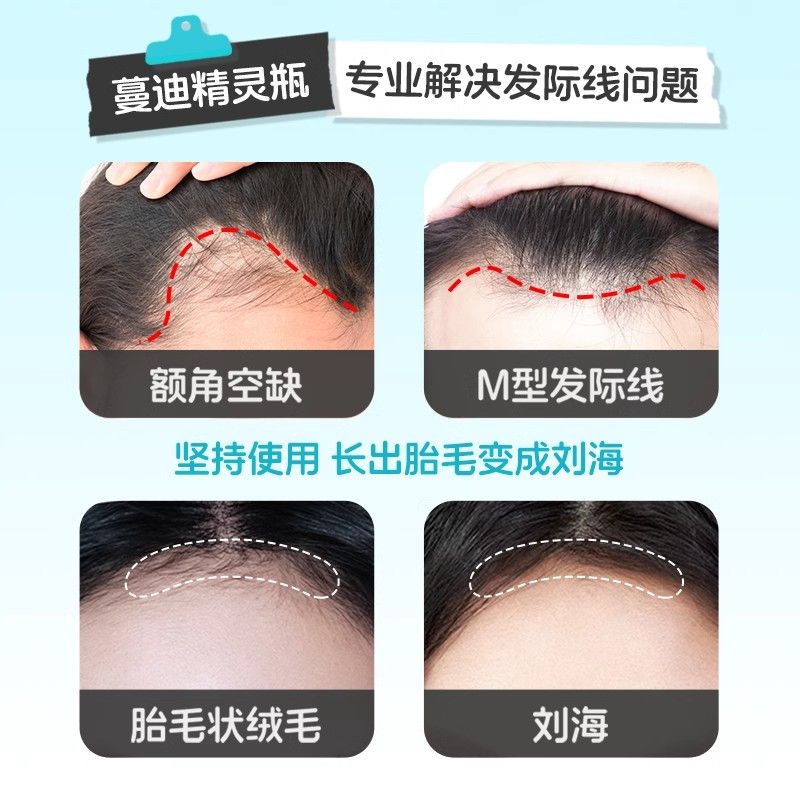 蔓迪 米诺地尔酊 10ml*3瓶/盒 发际线增长液便捷男女掉发脱发斑秃生发液喷雾曼迪正品官方旗舰店 图片 3