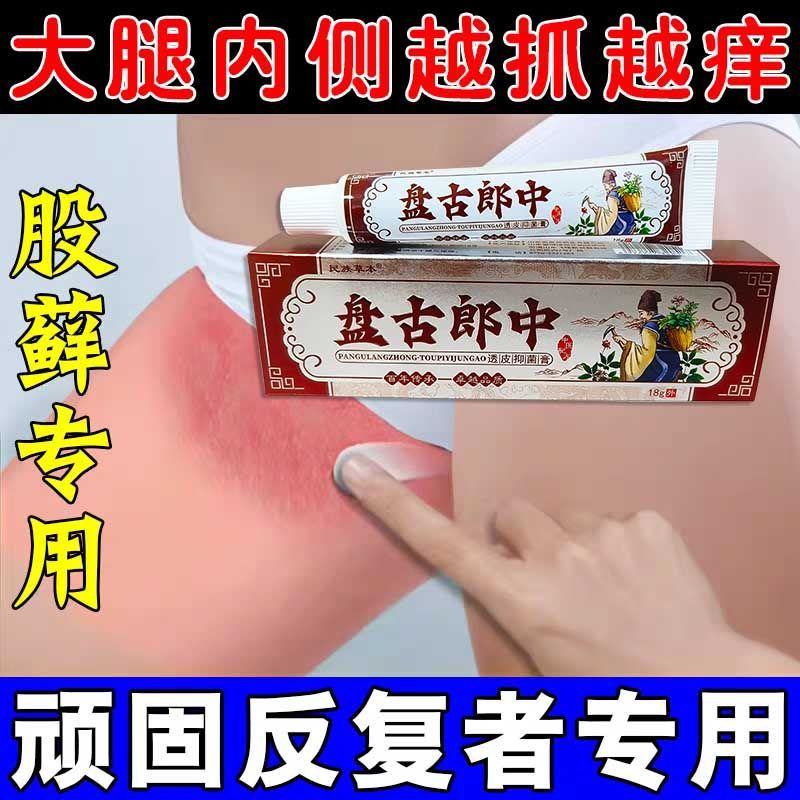 屁股臀部两边长红疙瘩痘痘越挠越大久坐外用草本抑菌乳膏