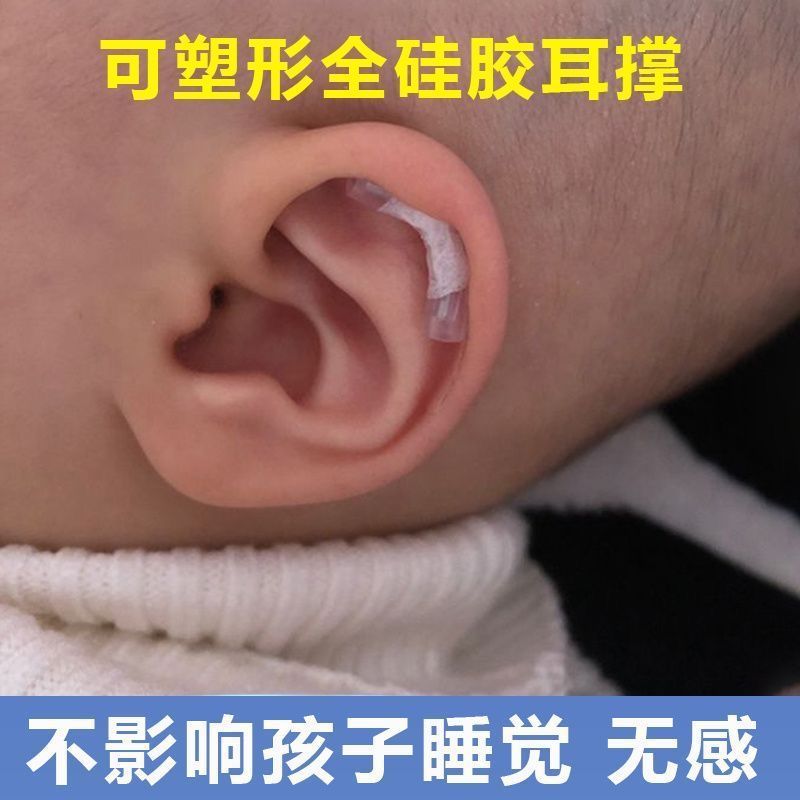 硅胶婴儿耳朵矫正器耳廓矫形新生儿畸形耳型垂耳纠正定型神器胶卷