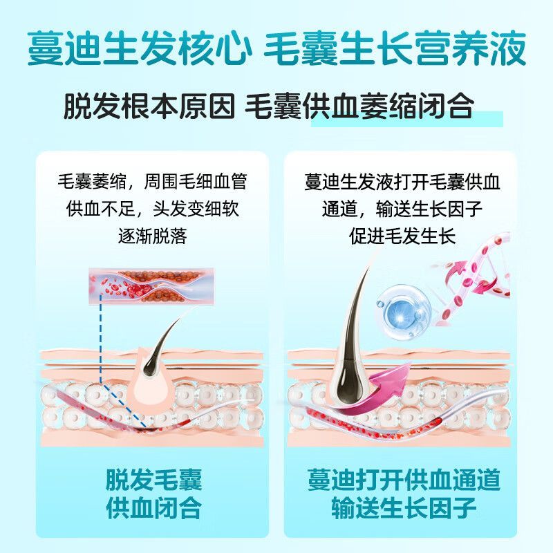蔓迪 米诺地尔酊 10ml*3瓶/盒 发际线增长液便捷男女掉发脱发斑秃生发液喷雾曼迪正品官方旗舰店 图片 4