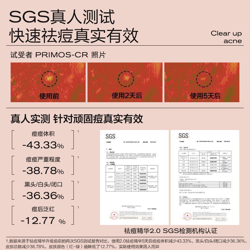 大水滴3点祛痘精华2.0升级 快速祛痘淡化红印水杨酸剥脱催熟瘪痘 图片 2