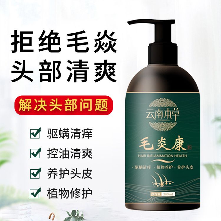 云南本草何首乌洗发水头皮癣毛囊除螨控油清痒养护头皮清洁洗发液