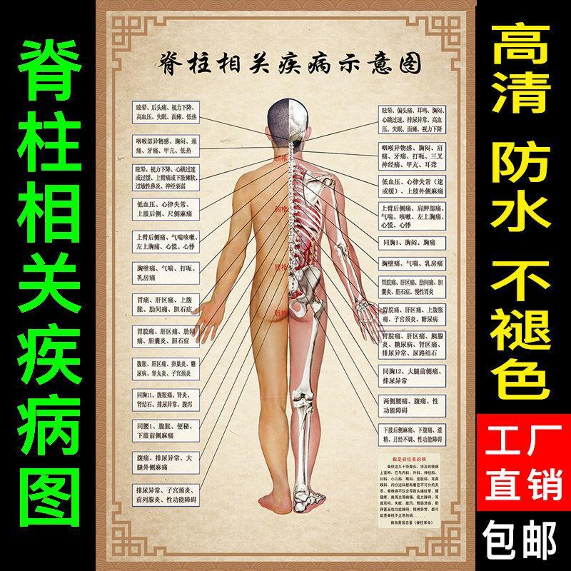 脊柱相关疾病示意图脊椎神经挂图人体经络穴位肩颈病症海报画高清