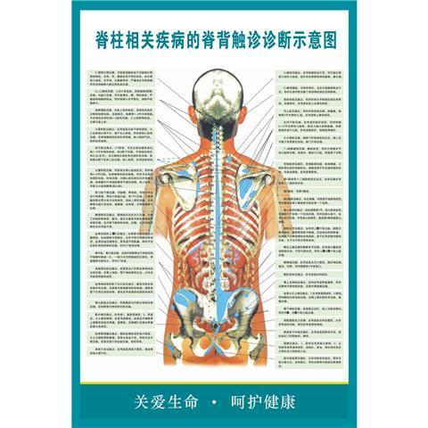 脊柱相关疾病的脊背触诊诊断示意图海报医学医院人体器官挂图