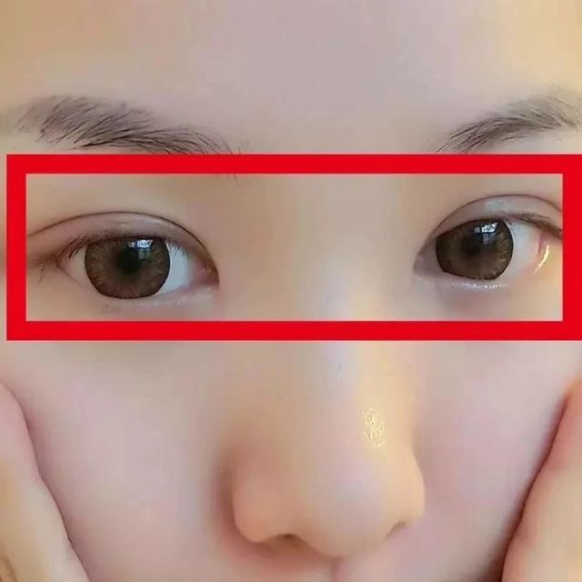 双眼皮定型霜单眼皮内双肿眼泡神器精华霜非胶水蕾丝