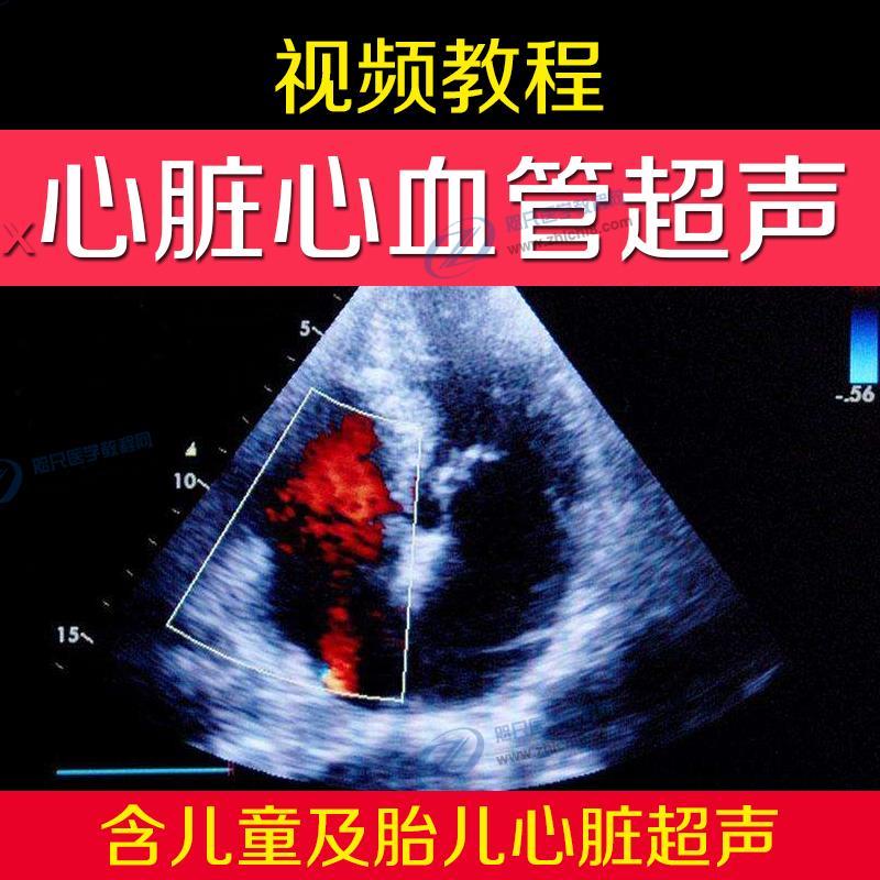 胎儿心脏心血管超声视频教程b超声心动图先心病影像诊断教程