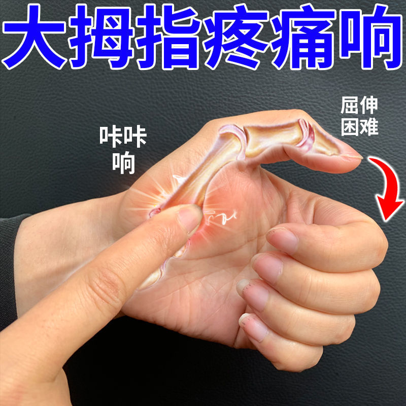 不用开刀】腱鞘炎大拇指手指伸屈困难疼痛腱鞘囊肿鼓包弹响痛特效