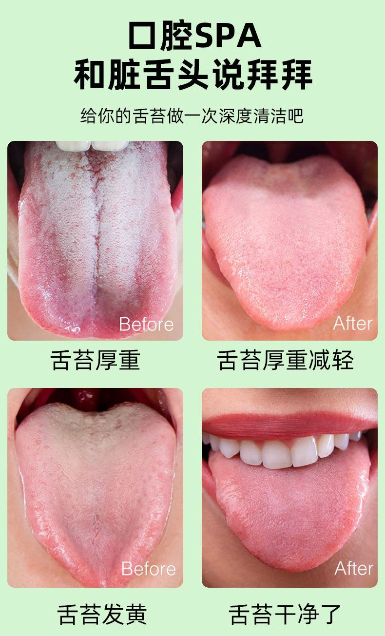台灣現貨 舌苔清潔啫喱口腔護理清新口氣舌苔的刮舌器抖音快手清潔刷啫喱膏 Yahoo奇摩拍賣
