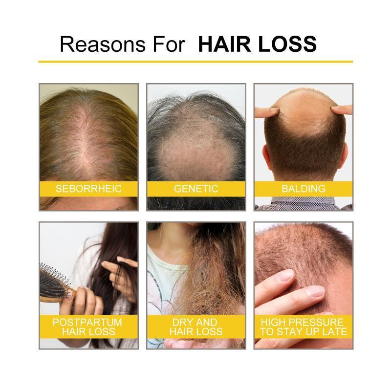 Essenzöl spendet Feuchtigkeit, repariert Wurzeln und geschädigtes Haar, stärkt und festigt das Haar_voghion.com