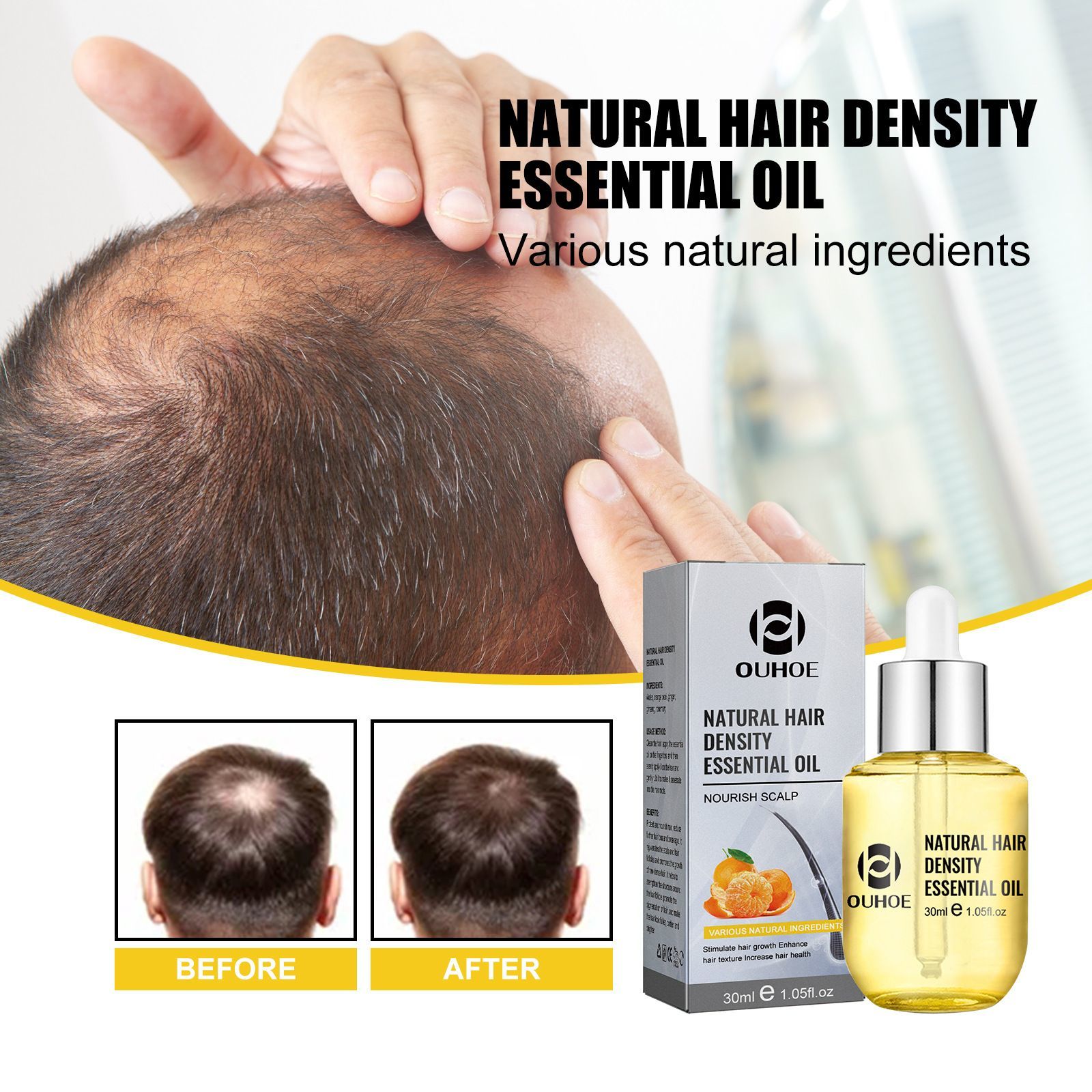 Essence Oil Moisturizes Dense Repairs Roots, Damaged Hair, Strengthens and Firms Hair_voghion.com