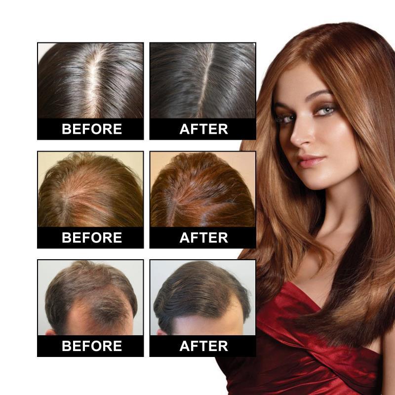 Essenzöl spendet Feuchtigkeit, repariert Wurzeln und geschädigtes Haar, stärkt und festigt das Haar_voghion.com