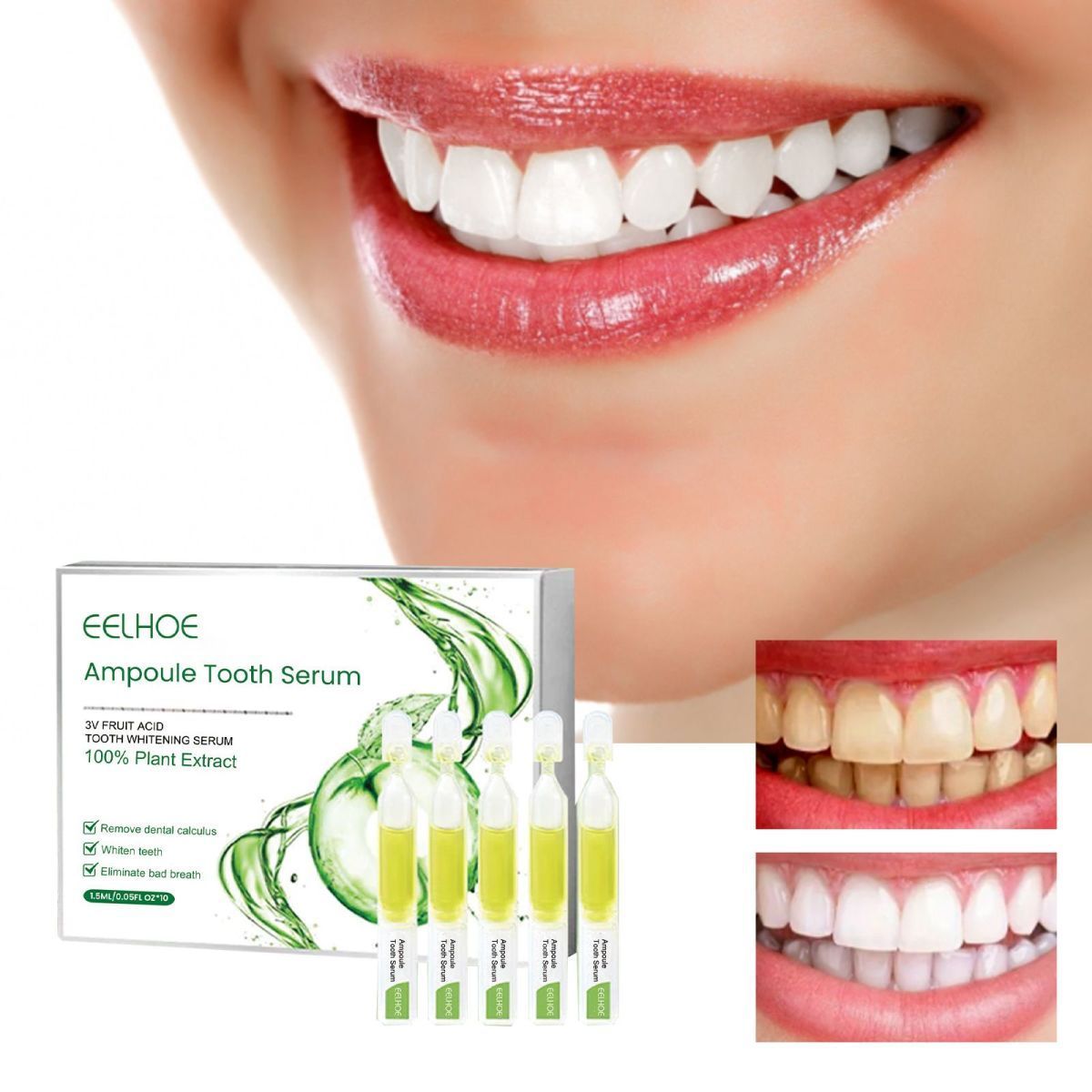 Whitening Teeth Serum to remove stains, bad breath, Whitening Teeth, Whitening Teeth_voghion.com