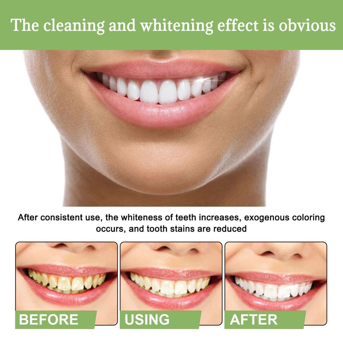 Whitening Teeth Serum to remove stains, bad breath, Whitening Teeth, Whitening Teeth_voghion.com