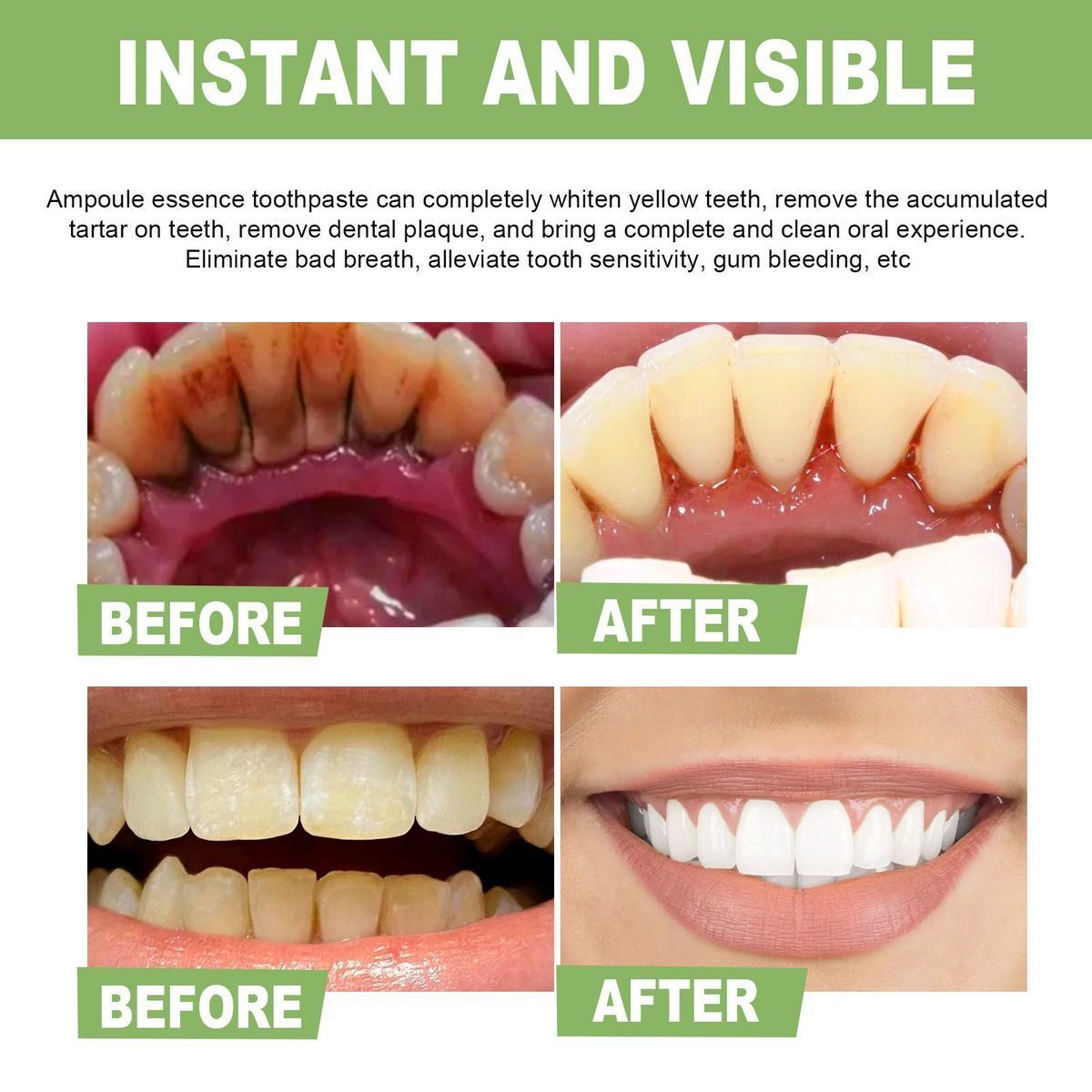 Whitening Teeth Serum to remove stains, bad breath, Whitening Teeth, Whitening Teeth_voghion.com