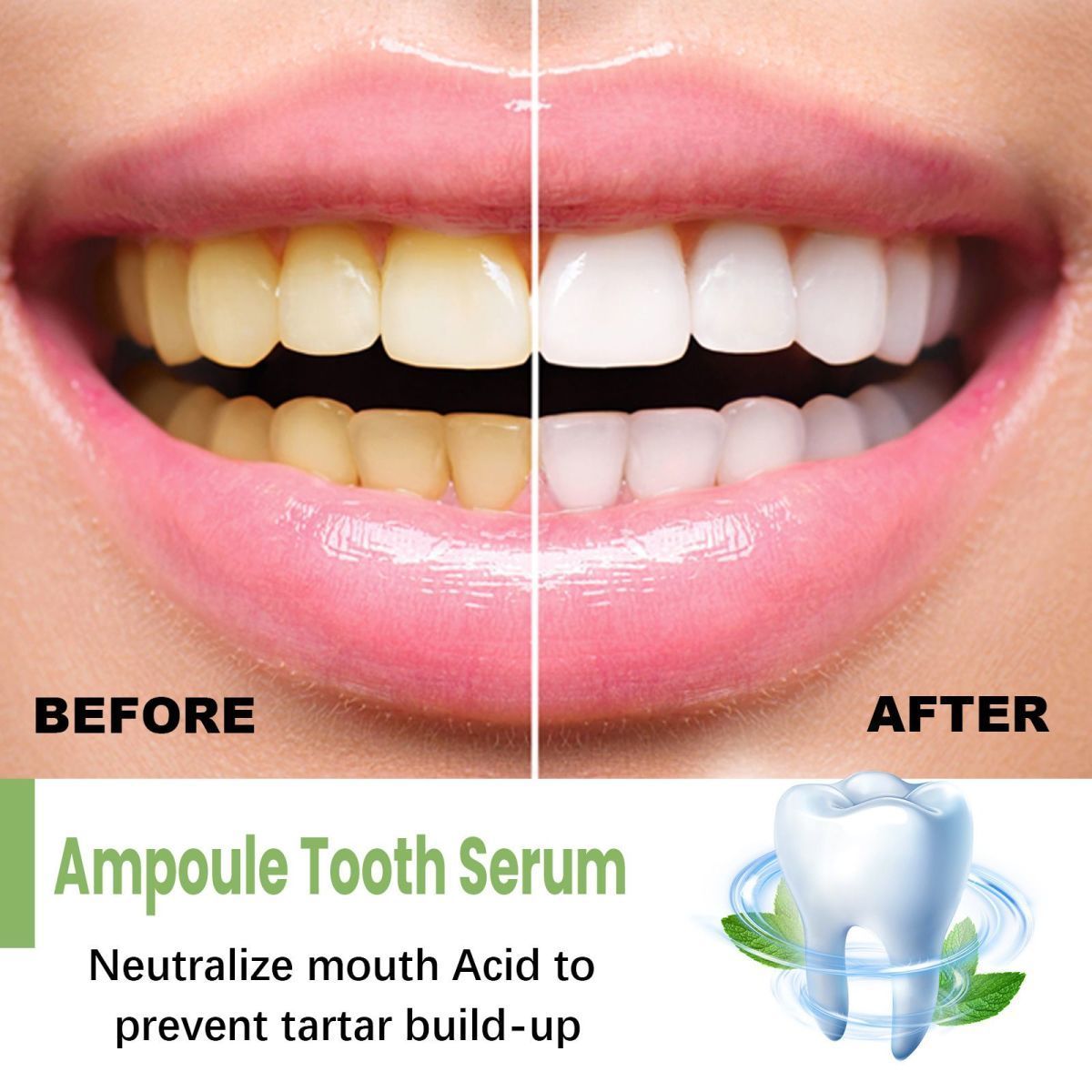 Whitening Teeth Serum to remove stains, bad breath, Whitening Teeth, Whitening Teeth_voghion.com