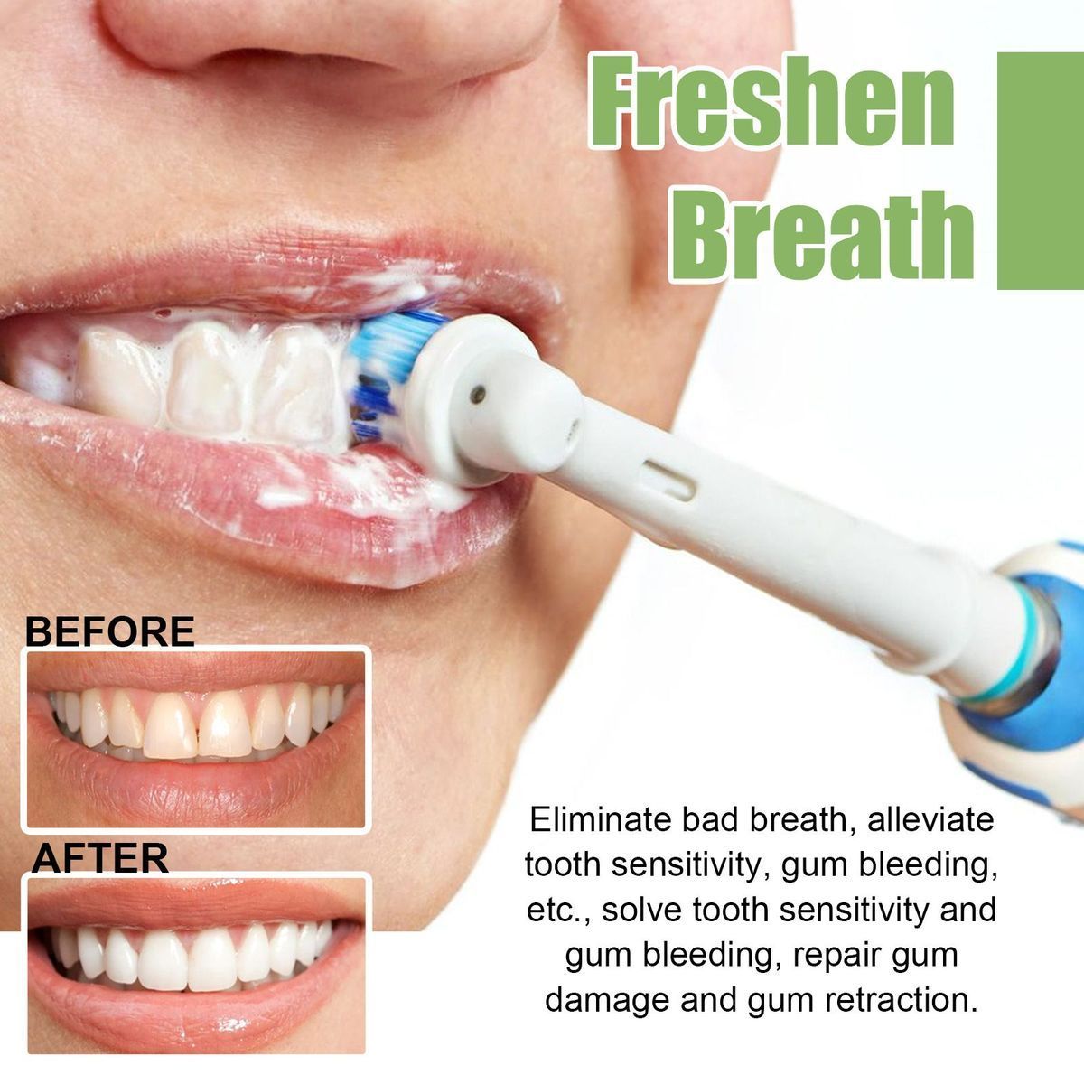 Whitening Teeth Serum to remove stains, bad breath, Whitening Teeth, Whitening Teeth_voghion.com
